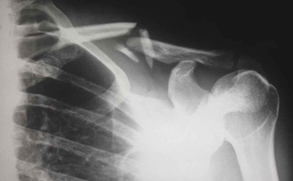 When will Physiotherapists be authorized to order XRays and Ultrasounds? Focusphysiotherapy