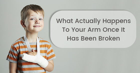 What Actually Happens To Your Arm Once It Has Been Broken