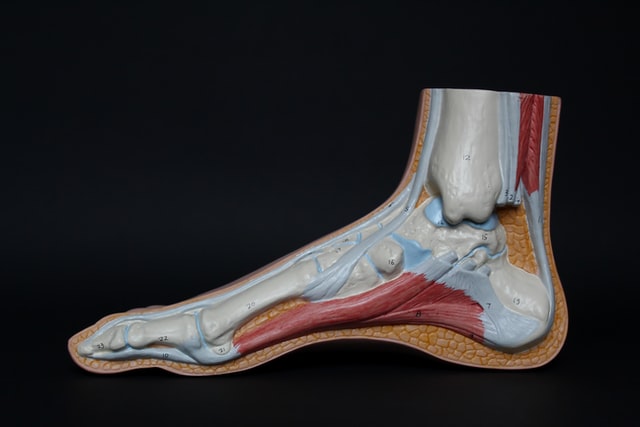 Custom Foot Orthotics Brampton