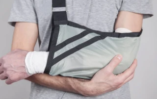 Regaining Strength: How A Broken Arm Affects Movement And Muscles - Photo 23