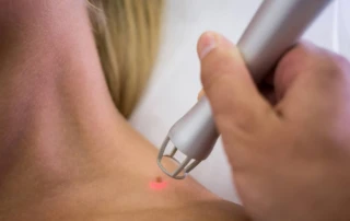 Dealing With Chronic Pain? How Laser Therapy Can Help - Photo 17